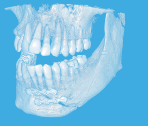 tomografia zębów, szczęki Białystok